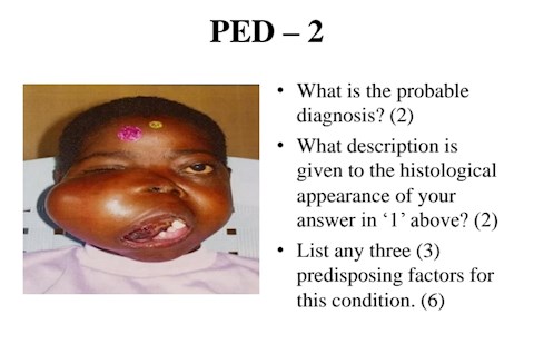 pediatrics-osce-questions