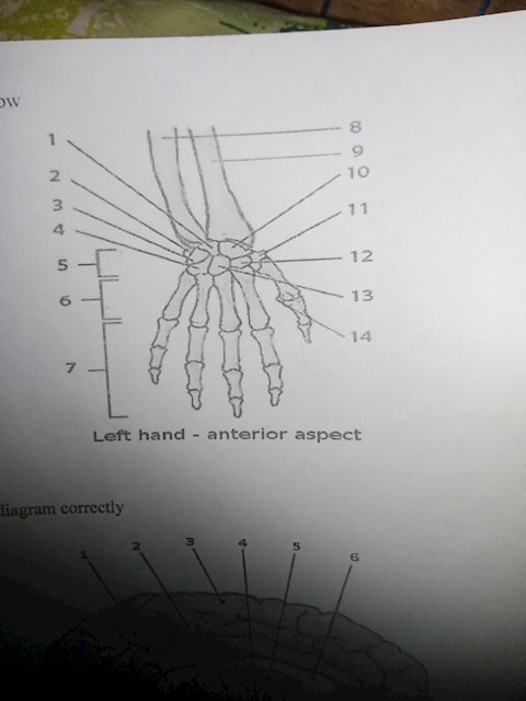 mentioned-14-left-hand-anterior-inorder-and-the-diagram-correctly