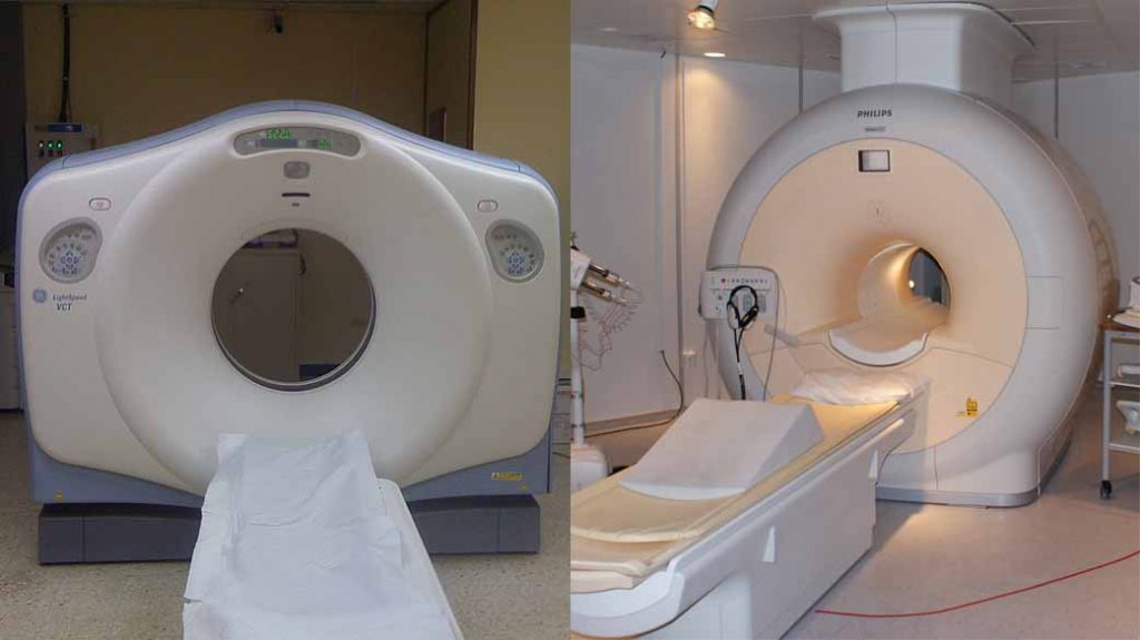 Care este diferența între CT și RMN?