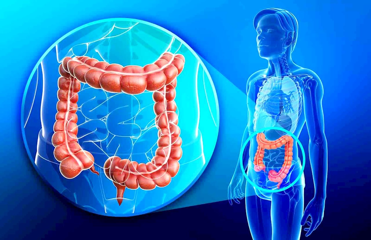 What is colon infection?